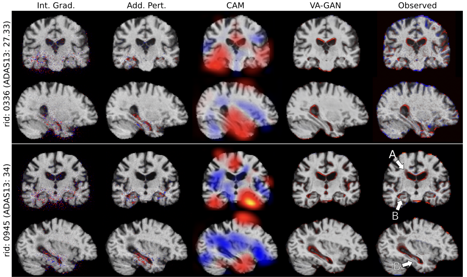 Visual Feature Attribution Using Wasserstein GANs
